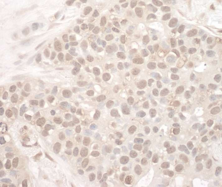 Polyclonal Rabbit anti-Human EYA2 Antibody (aa100-150, IHC)