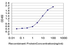 XPC Antibody (clone 6D11)