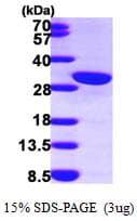 Human CALB2 / Calretinin Protein (Recombinant His)