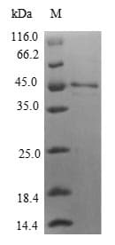 Human IL1F9 Protein (Recombinant GST, N-terminus)