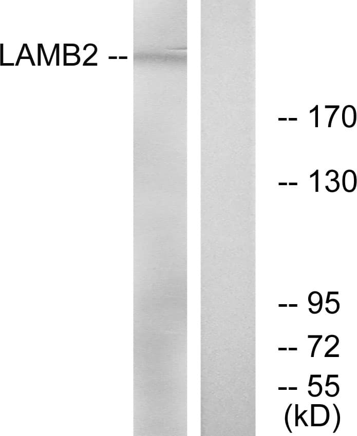 LAMB2 / Laminin Beta 2 Antibody (aa61-110)