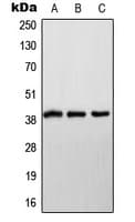 NDUFA9 Antibody (Internal)