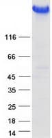Human TG / Thyroglobulin Protein (Recombinant Myc-DDK (Flag))