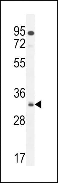 NUSAP1 / NUSAP Antibody (aa27-56)