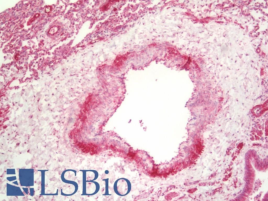 IHC-plus™ PRKCDBP / CAVIN3 Antibody