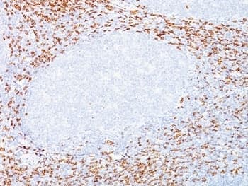 CD8A / CD8 Alpha Antibody (C-Terminus, clone C8/468 + C8/144B)