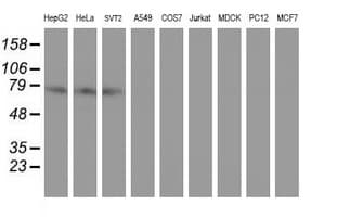 CNOT4 / CLONE243 Antibody (aa190-455, clone OTI3D11)