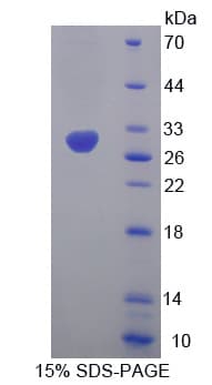 Mouse HMGCS1 / HMG-CoA Synthase 1 Protein (Recombinant His-T7)