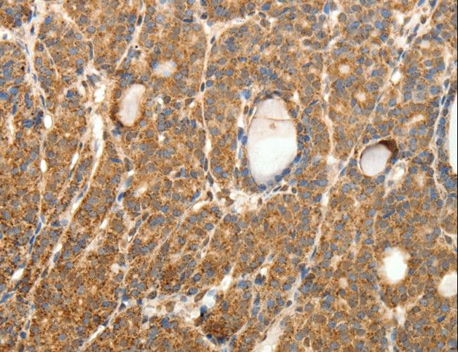 Polyclonal Rabbit anti-Human SYT11 Antibody (IHC)