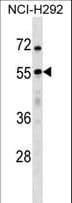 USP27X Antibody (aa1-30)
