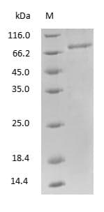 Rat TF / Transferrin Protein (Native)