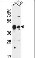 PSPLA1 / Phospholipase A1 Antibody (aa329-358)