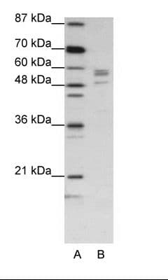 SARS / Serine-tRNA Ligase Antibody (C-Terminus)