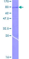 Human DCT / Dopachrome Tautomerase Protein (Recombinant GST)