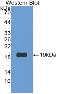 PCOLCE2 Antibody (aa154-269)