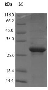 Human MED1 / TRAP220 Protein (Recombinant 6His-SUMO, N-terminus)