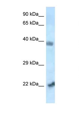 VPS72 Antibody (N-Terminus)