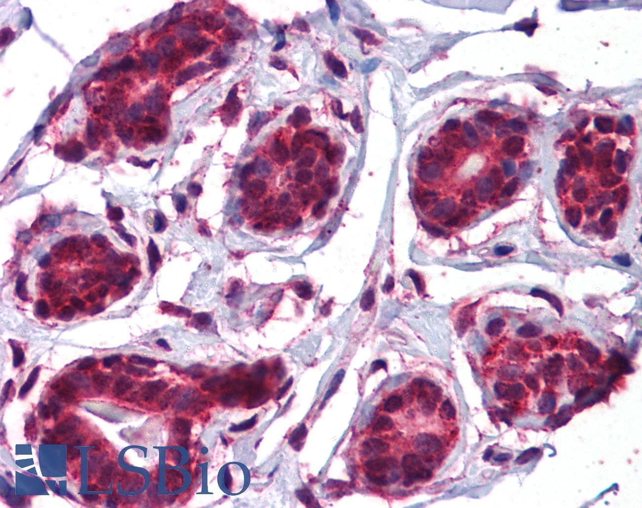 IHC-plus™ Polyclonal Rabbit anti-Human KDM8 / JMJD5 / FLJ13798 Antibody (IHC, IF, WB)