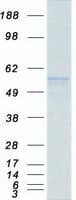 Human Peripherin Protein (Recombinant Myc-DDK (Flag))
