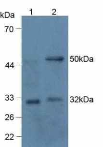 TNFSF11 / RANKL / TRANCE Antibody
