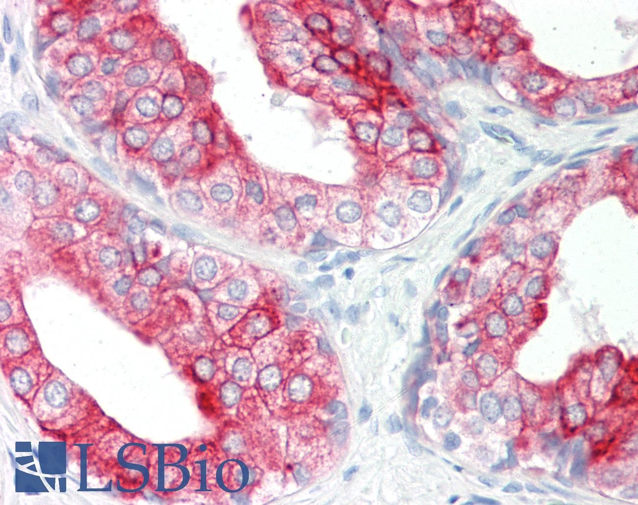 Polyclonal Rabbit anti-Human KRT8 / CK8 / Cytokeratin 8 Antibody (aa198-246, IHC, WB)