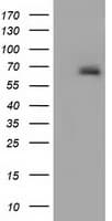 Alpha-Fetoprotein Antibody (clone OTI3G3)