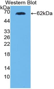 PRKCQ / PKC-Theta Antibody (aa380-634, Biotin)
