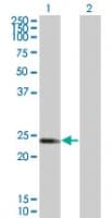KCNIP1 / KCHIP1 Antibody (clone 6C239.4)