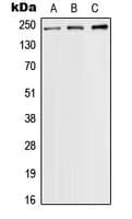 SCN9A / Nav1.7 Antibody (Internal)