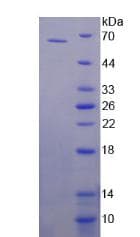 Human SP1 Protein (Recombinant His-GST)