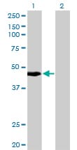 KRT34 / Keratin 34 / KRTHA4 Antibody (clone 3E5)