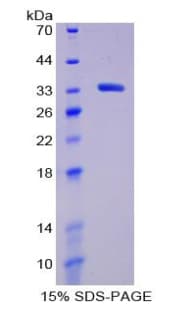 Human LAG3 Protein (Recombinant His-T7)