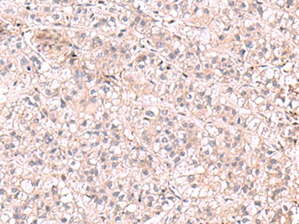 KCNK18 / TRESK Antibody