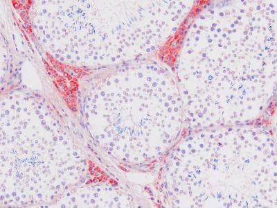 Monoclonal Mouse anti-Porcine Keratin, Basal Cell Antibody (clone PLB42, IHC, WB)