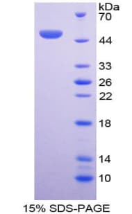 Human BMP7 Protein (Recombinant His-T7)