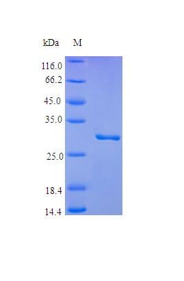 Human PLG / Plasmin / Plasminogen Protein (Recombinant)