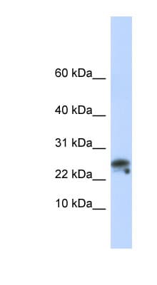 GNLY / Granulysin Antibody (C-Terminus)