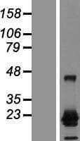 CTAG1A Protein (Over-Expression Lysate Myc-DDK (Flag))