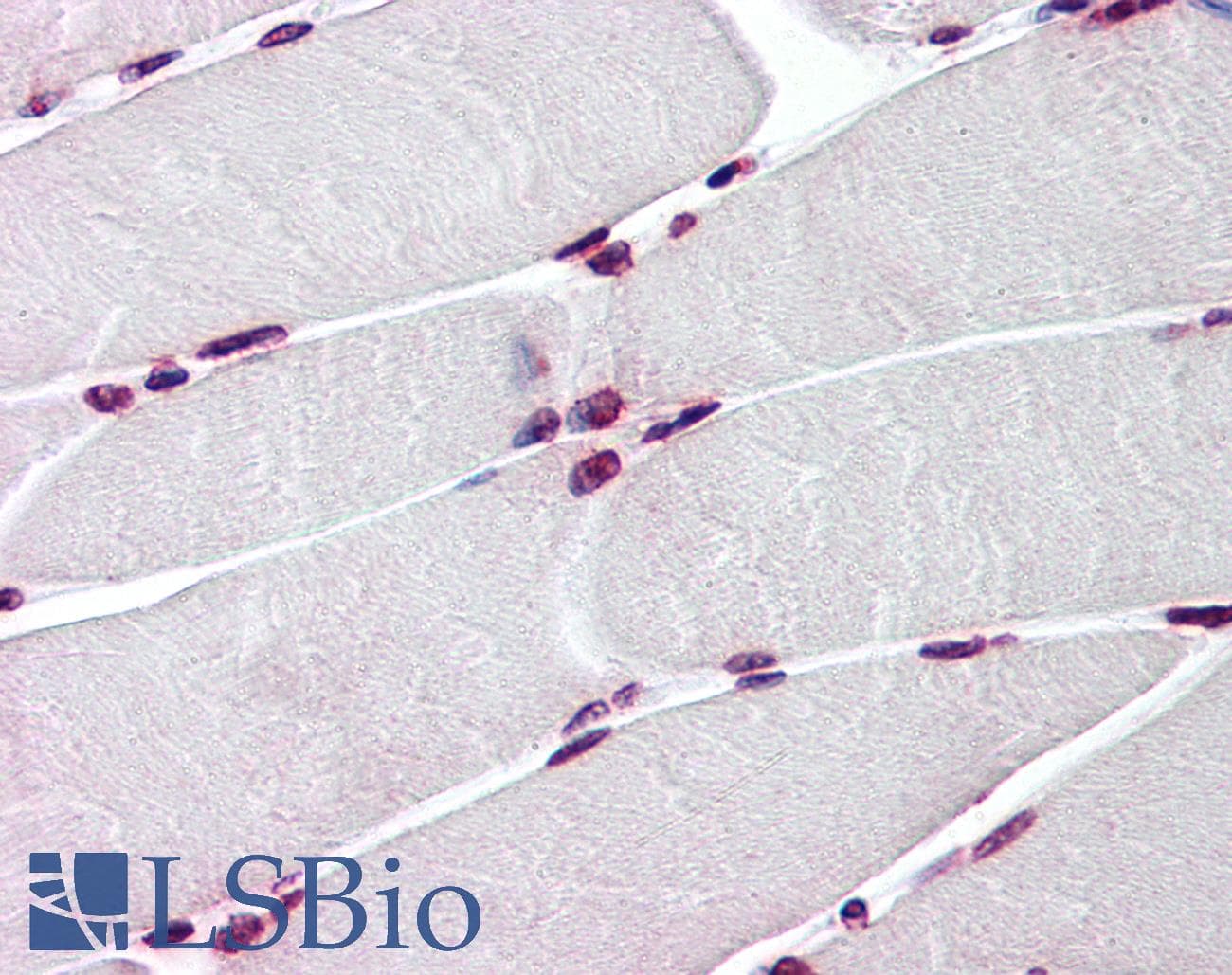 IHC-plus™ BAZ1B / WSTF Antibody (clone 5E9)