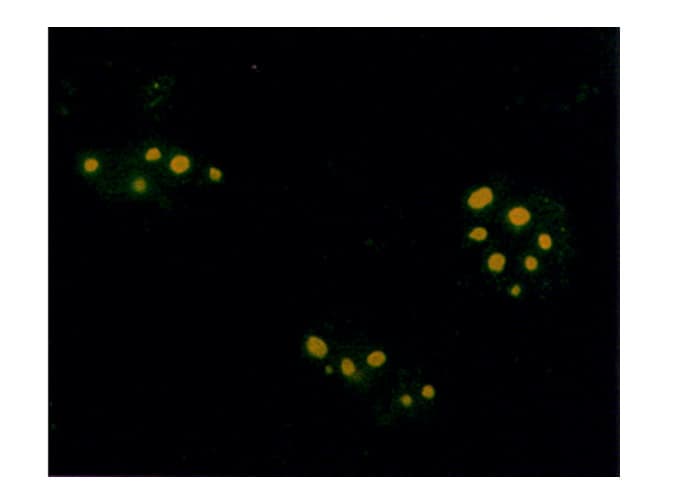 Farnesyl Antibody