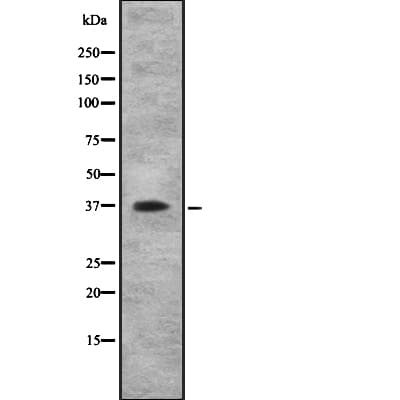 Polyclonal Rabbit anti-Human IL10RB Antibody (WB)