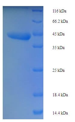 Phytolacca dioica Ribosome-inactivating Protein PD-L1/PD-L2 (Recombinant His-SUMO)