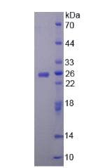 Human CHRNA4 / NACHR Protein (Recombinant His-T7)