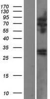 RTBDN / Retbindin Protein (Over-Expression Lysate Myc-DDK (Flag))