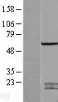 Human SPATA2 Protein (Over-Expression Lysate Myc-DDK (Flag))
