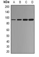CTNNB1 / Beta Catenin Antibody (Internal)