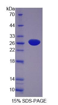 Human PER1 Protein (Recombinant His-S)