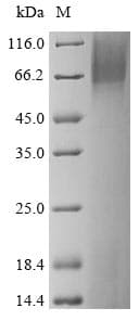 Mouse TEM7 Protein (Recombinant 6His, N-terminus)