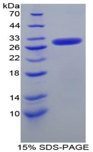 Mouse NUP50 Protein (Recombinant His-T7)