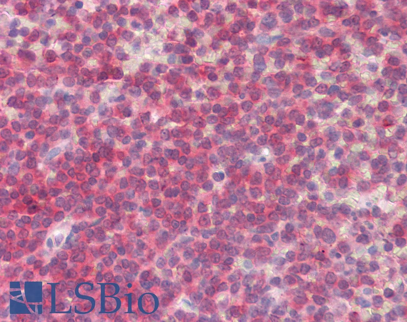 IHC-plus™ BLK Antibody (aa22-34)